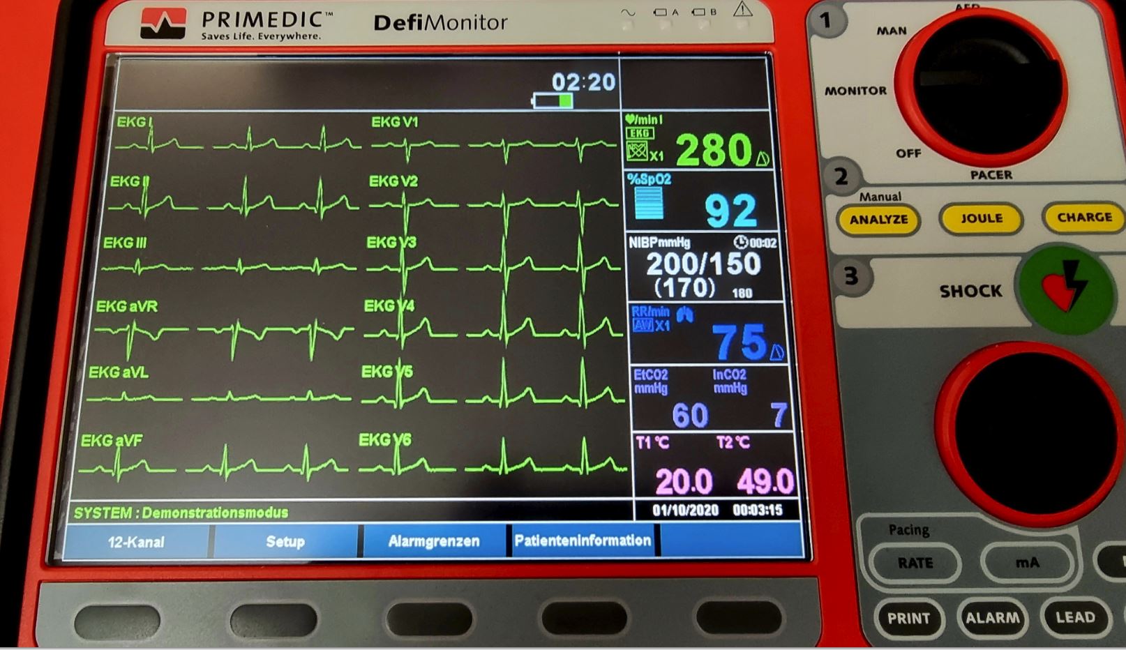  Defibrillator  Primedic EVO III - 12 Kanal - Bild 3