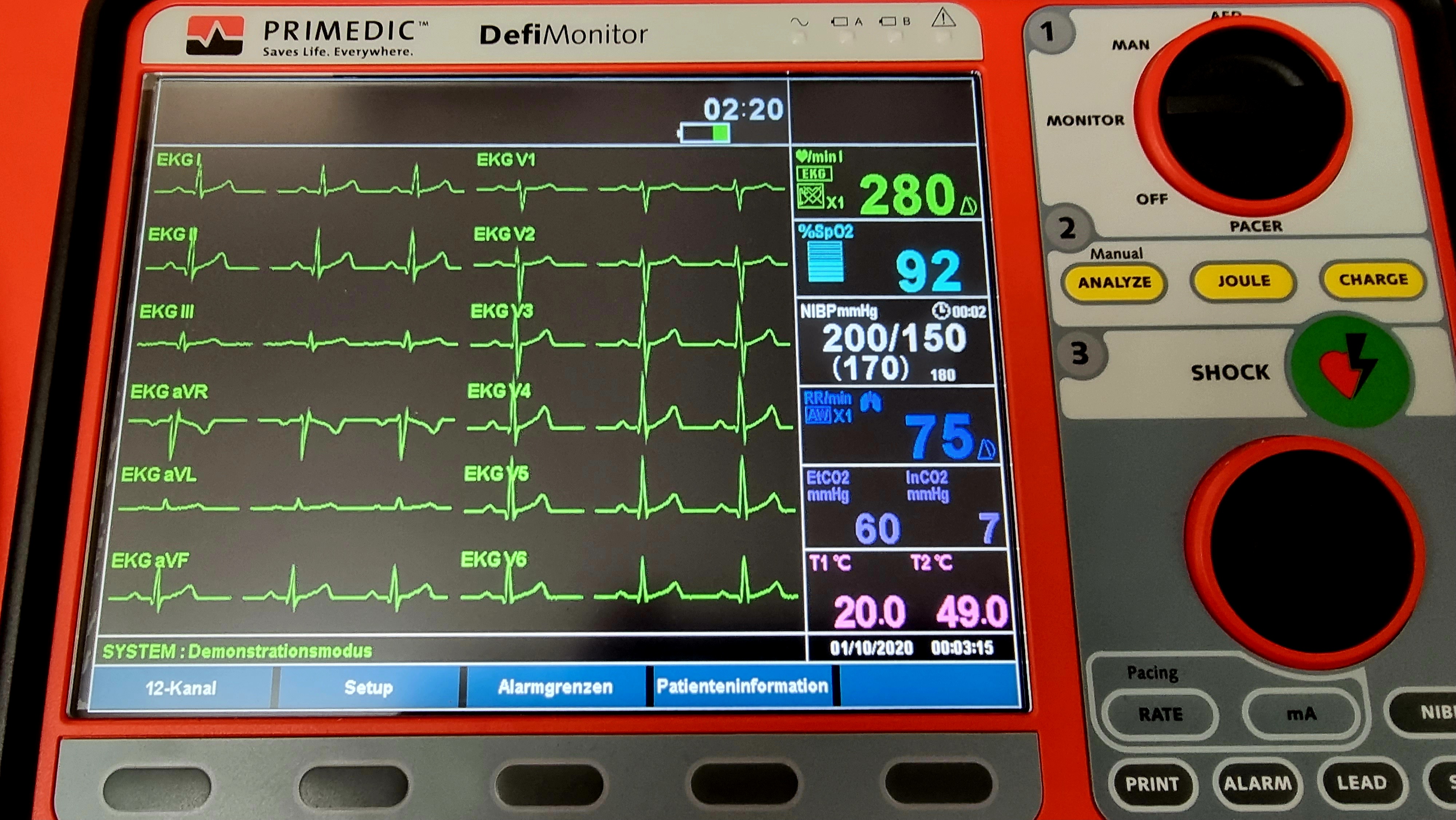 Defibrillator Primedic EVO III 12 Kanal - Bild 4