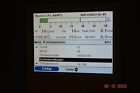 Respironics Trilogie 100 Ventilator 1640 Stunden - Bild 4