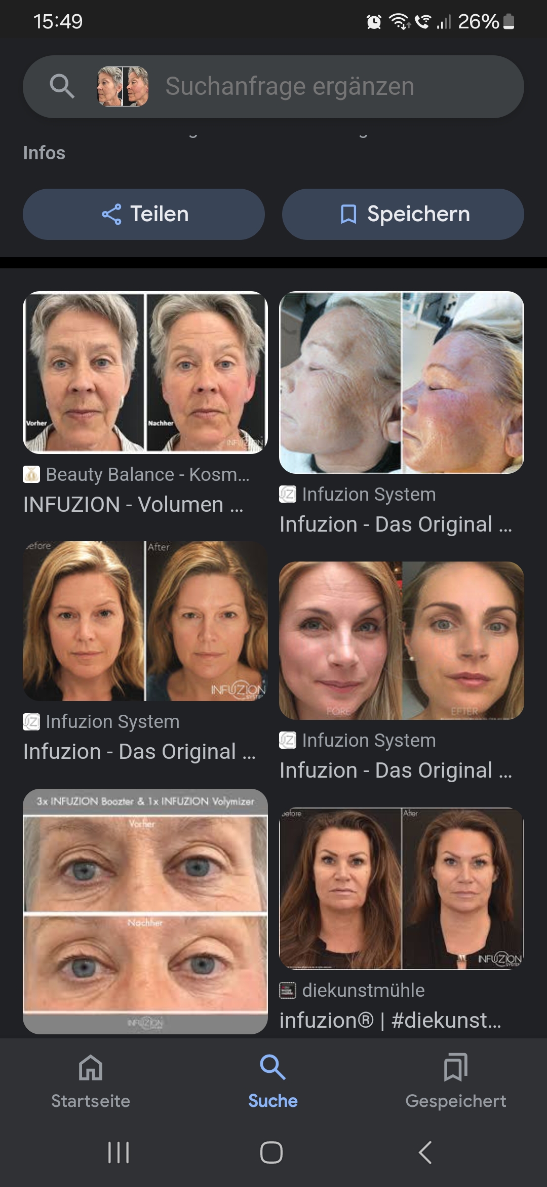 Infuzion System