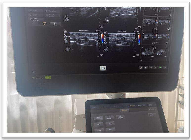 Ultraschallgerät Philips Affinity W 50 mit DICOM - Bild 2