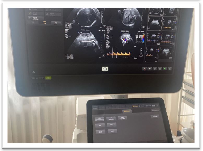 Ultraschallgerät Philips Affinity W 50 mit DICOM - Bild 3