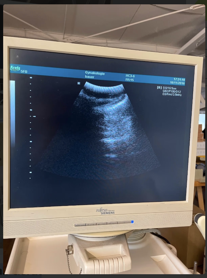 Kretz Sonoace 6000 C mit 4 Sonden Ultraschallgerät - Bild 3