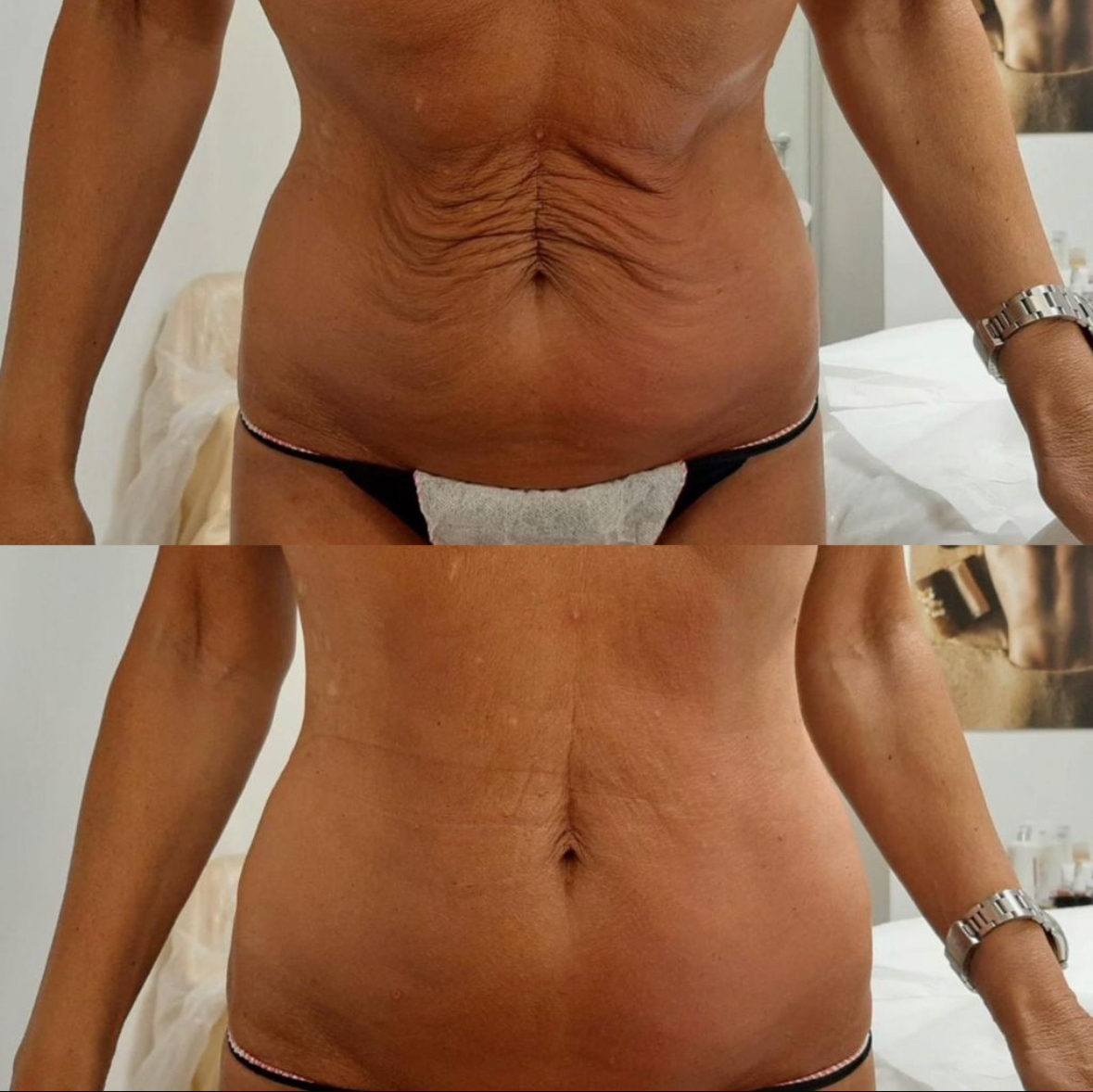 T-SHAPE 2 by BALDAN - das 5in1 WUNDER! - Bild 2