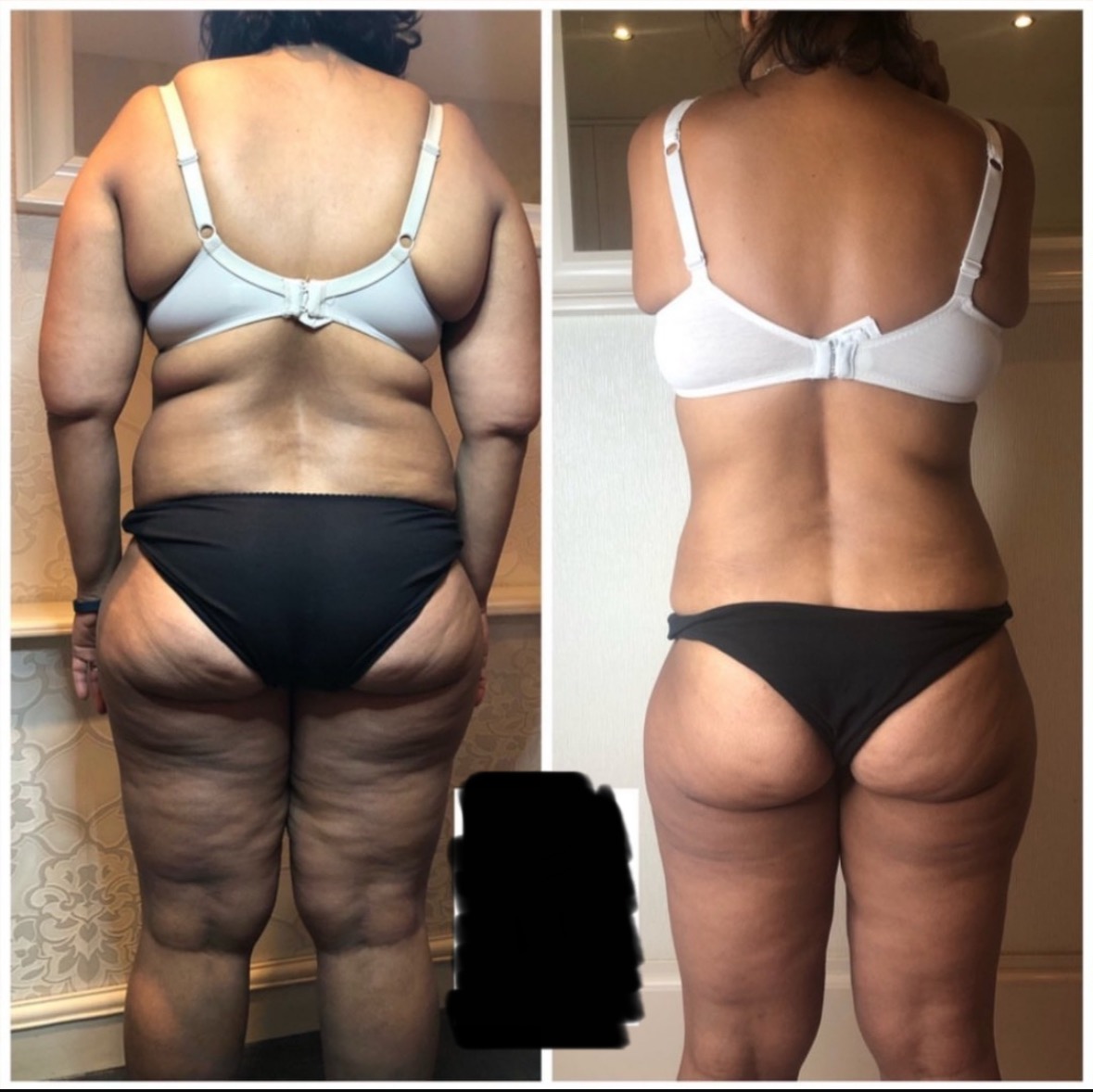 T-SHAPE 2 by BALDAN - das 5in1 WUNDER!